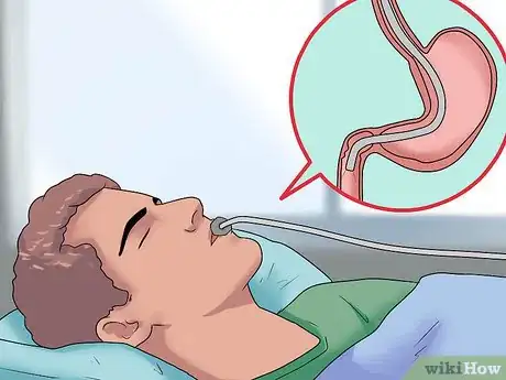 Image titled Test for Upper Gastrointestinal Bleeding Step 5