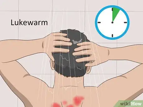 Image titled Heal Red Skin Step 8