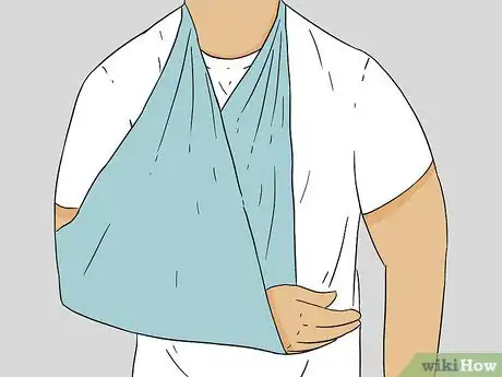 Image titled Diagnose a Broken Thumb Step 14