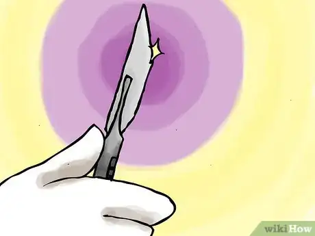 Image titled Remove Corns from Your Toes Step 21