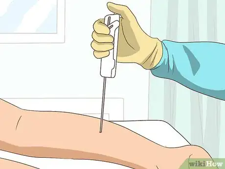 Image titled Diagnose Motor Neuron Diseases Step 13