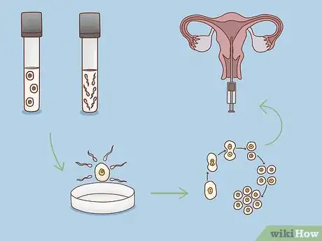 Image titled Get Fertility Treatments Step 15