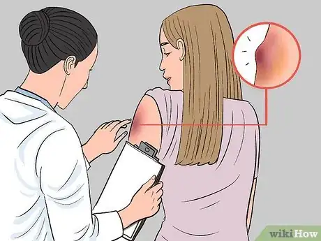 Image titled Care for a Bruise Naturally Step 11