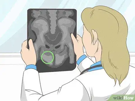 Image titled Treat Inguinal Hernia Step 8