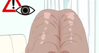 Get Rid of Lice in Your Home