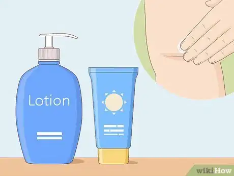 Image titled Remove Spider Veins Step 6