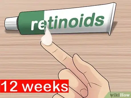 Image titled Get Rid of Cystic Acne Scars Step 19