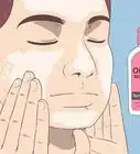 Get Rid of Acne if You Have Fair Skin