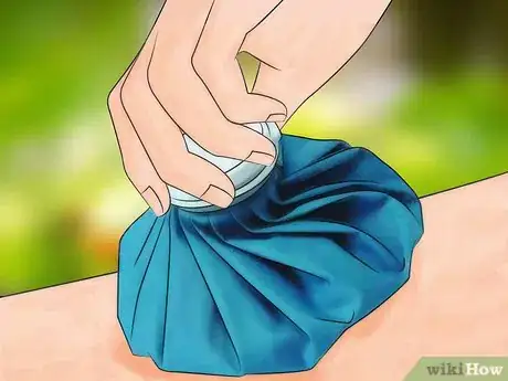 Image titled Identify Insect Bites Step 11