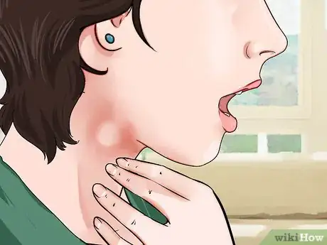Image titled Reduce Lymphoma Risk with Psoriasis Step 1