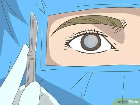 Image titled Treat Cataracts Step 8