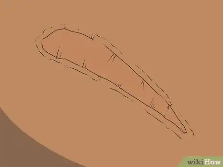 Image titled Know if a Wound Is Healing Step 9