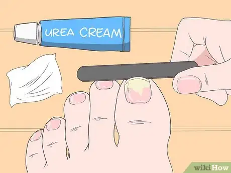 Image titled Trim Toenails with Fungus Step 2