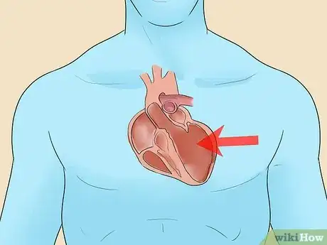 Image titled Identify Enlarged Heart Symptoms Step 23