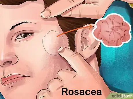 Image titled Choose Between Expert and Diy Beauty Treatments Step 1