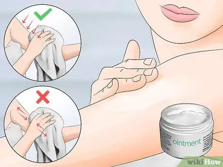 Image titled Prevent Dry Skin Step 3