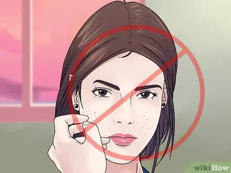 Image titled Get Rid of Cystic Acne Scars Step 18