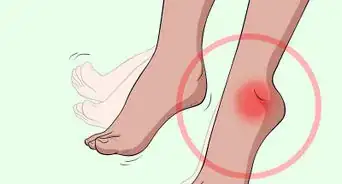 Treat MS‐Related Foot Drop