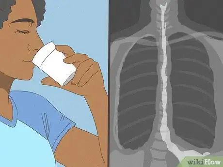 Image titled Diagnose Laryngopharyngeal Reflux Step 10