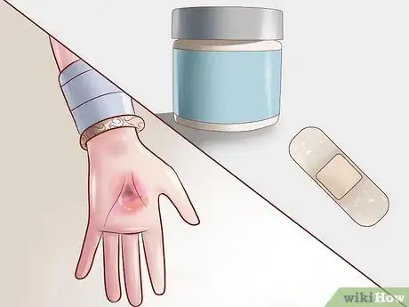 Image titled Treat Dry Hands Step 13