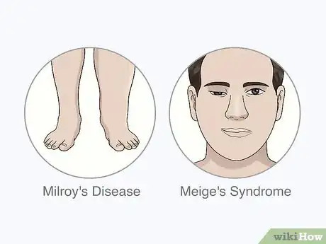 Image titled Identify Lymphedema Step 9