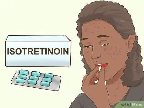 Image titled Know if You Need a Prescription Acne Treatment Step 11