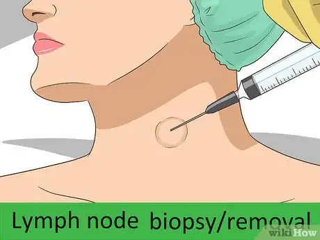 Image titled Diagnose Castleman Disease Step 8