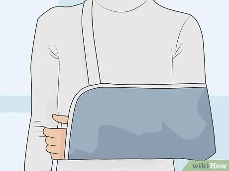 Image titled Heal an AC Joint Step 05