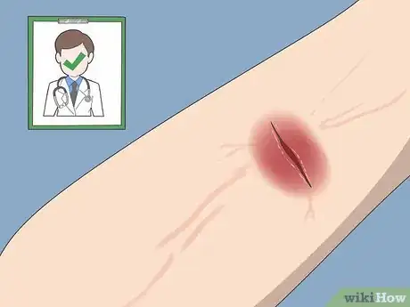 Image titled Know if a Wound Is Healing Step 1