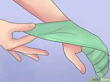 Image titled Heal Skin Damage from Frostbite Step 1