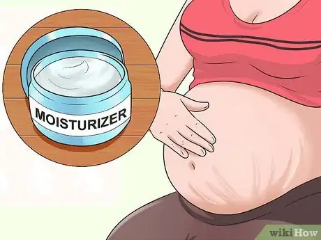 Image titled Prevent Stretch Marks Step 17