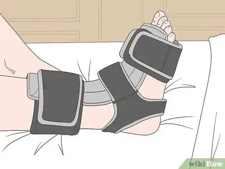 Image titled Wear a Dorsal Night Splint Step 7
