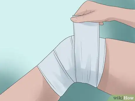 Image titled Deal with a Knee Sprain Step 3