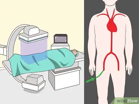 Image titled Diagnose TIA Step 17
