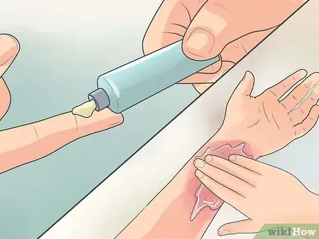 Image titled Use Antibiotics Effectively Step 17