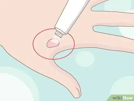 Image titled Take Care of Your Hands As a Rower Step 4