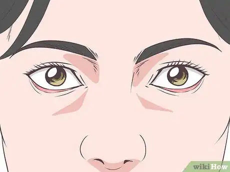 Image titled Recognize the Signs of Graves' Disease Step 13