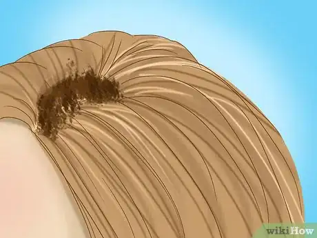 Image titled Get Rid of Lice Using Custard Apple Seed Paste Step 5