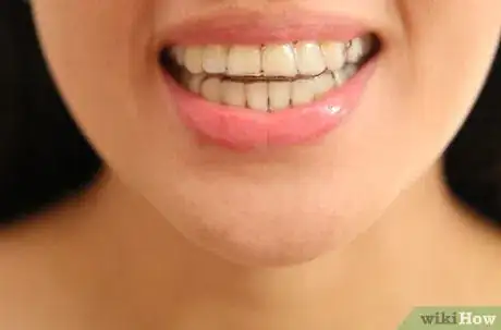 Image titled Whiten Your Teeth Without Spending a Lot of Money Step 4