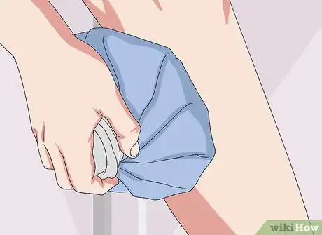 Image titled Heal a Bruise Step 4