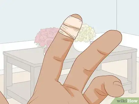 Image titled Treat a Blood Blister Step 6