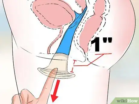 Image titled Use a Condom Step 22