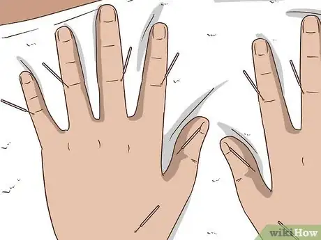 Image titled Ease Arthritis with Alternative Medicine Step 7