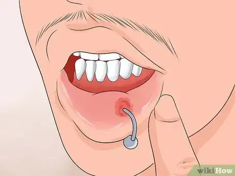 Image titled Take Care of a Lip Piercing Step 4