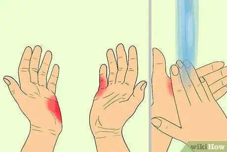 Image titled Get Spray Paint Off Skin Step 6