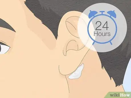 Image titled Patch Test Skin Step 14