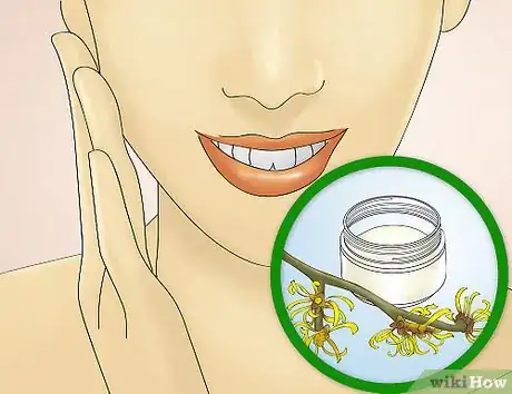 Image titled Reduce Redness After Waxing Step 20