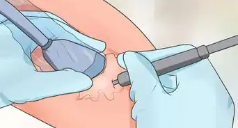 Alleviate Tendonitis