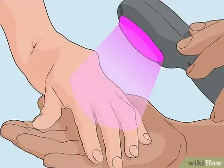 Image titled Treat Psoriasis with Phototherapy Step 04