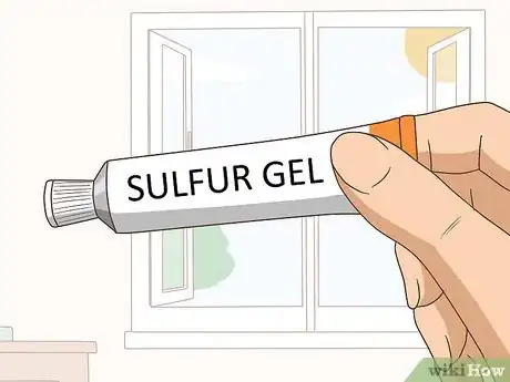 Image titled Get Rid of a Pimple Step 4